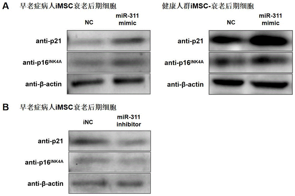 一种新型miRNA抑制物及其在体外缓解iMSC衰老中的应用