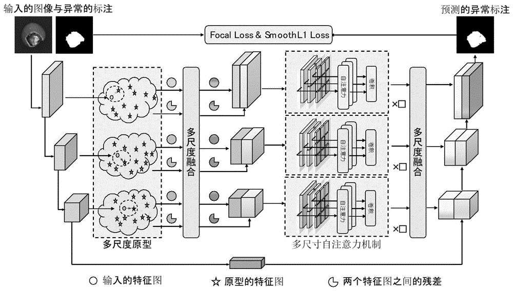 一种原型残差异常检测和定位方法