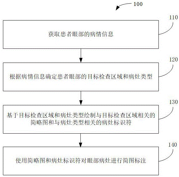 用于对眼部病灶进行简图标注的方法、装置及相关产品