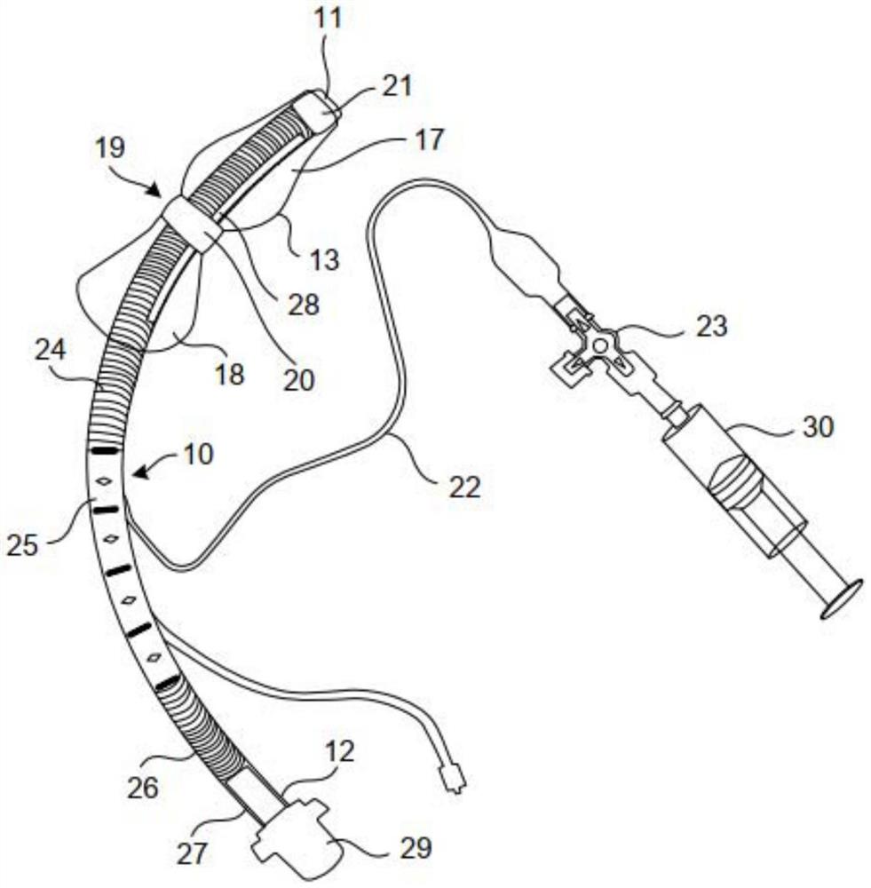 用于患者机械通气的气管内装置