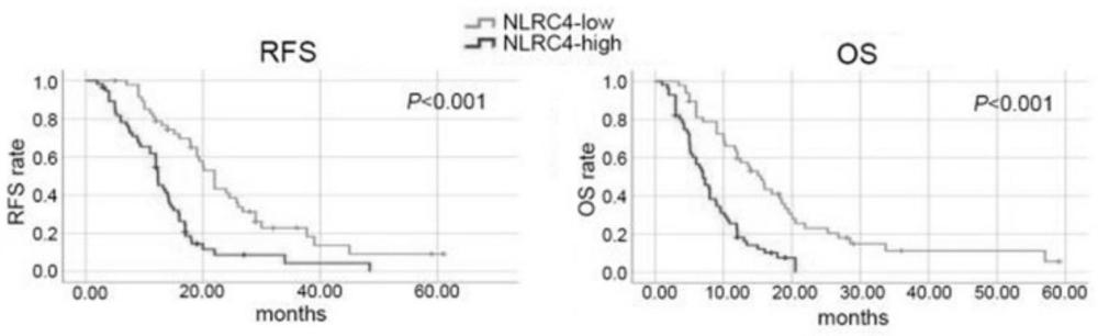 胰腺癌预后分子标志物NLRC4及检测试剂盒及其应用