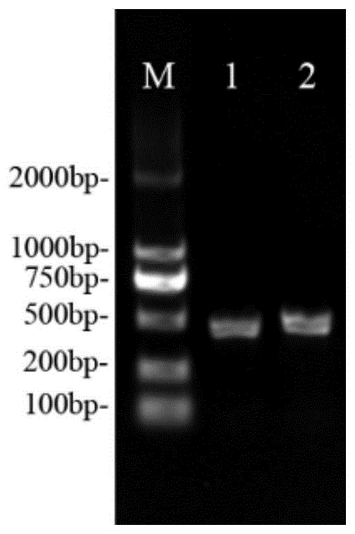 一种基于荧光定量PCR技术定量检测杜鹃花类菌根真菌的引物及检测方法
