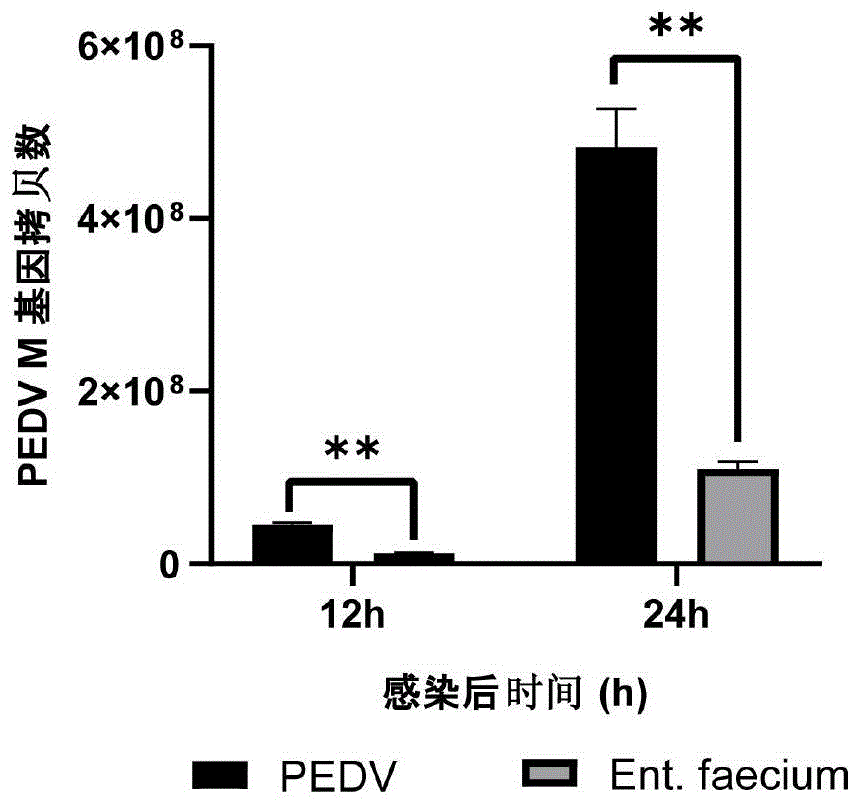 一株具有抗猪流行性腹泻病毒功能的屎肠球菌及其应用