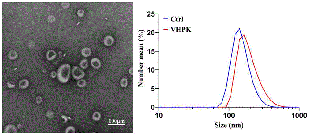 VHPK多肽修饰的荧光纳米脂质体给药系统、其制备方法及应用