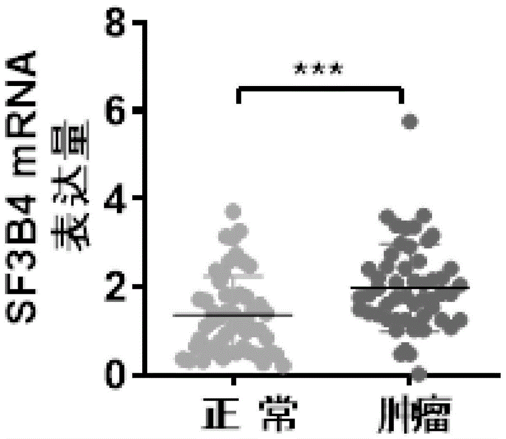 剪接因子SF3B4在制备肾透明细胞癌诊断及预后评估试剂盒中的应用