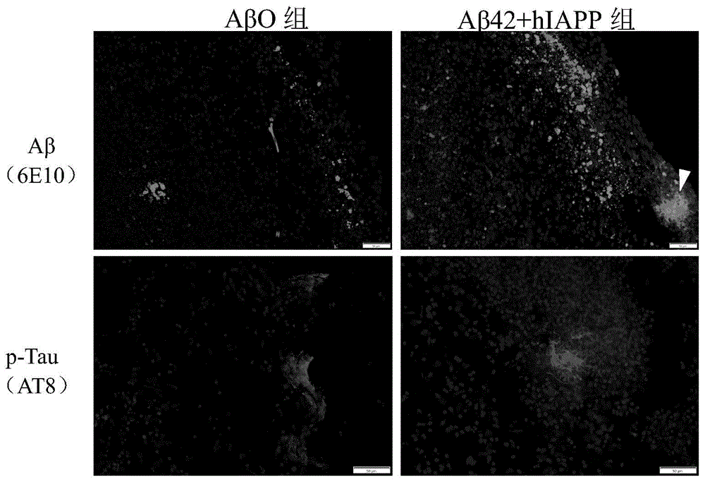 Aβ42-hIAPP共寡聚化物诱导的AD非人灵长类动物模型方法