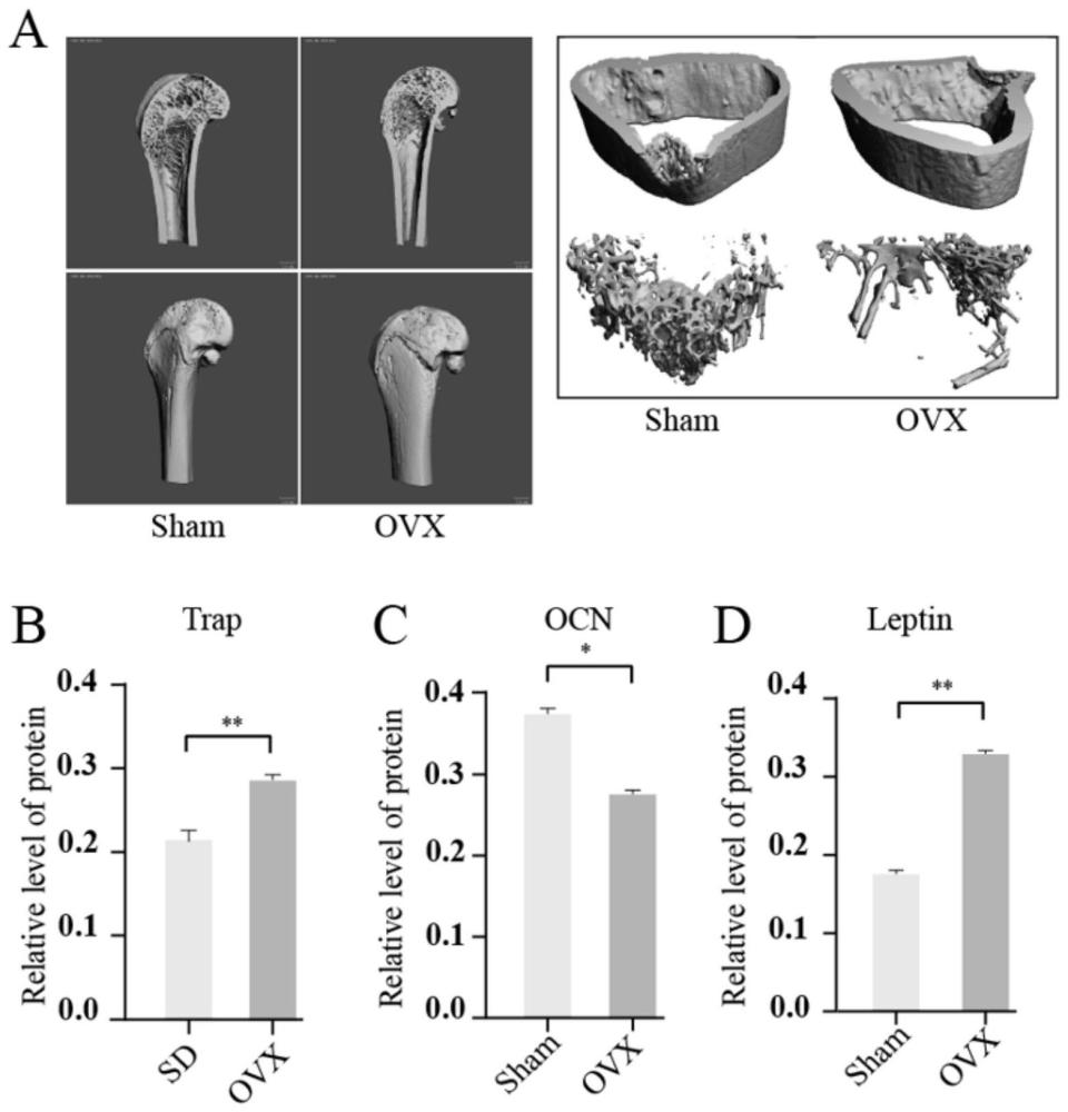 Leptin/Sirt5对BMP9诱导间充质干细胞成骨分化的影响