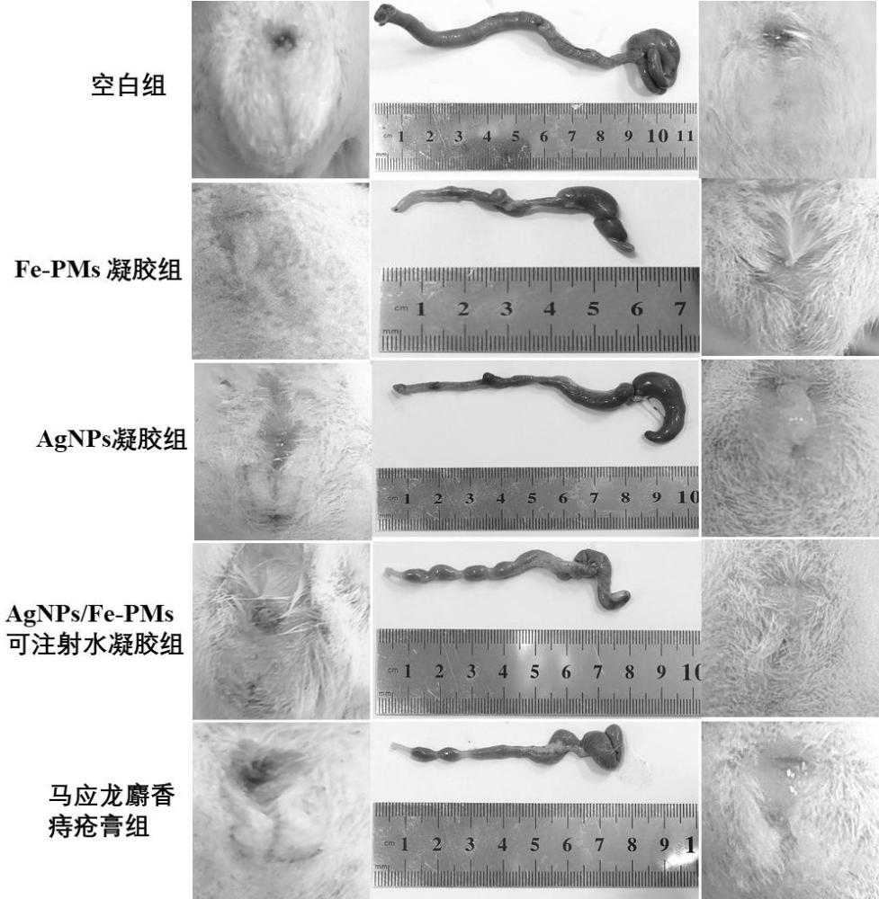 一种用于治疗痔疮纳米酶可注射水凝胶