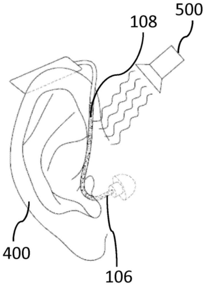 在听力设备的连接器上提供视觉标记的方法
