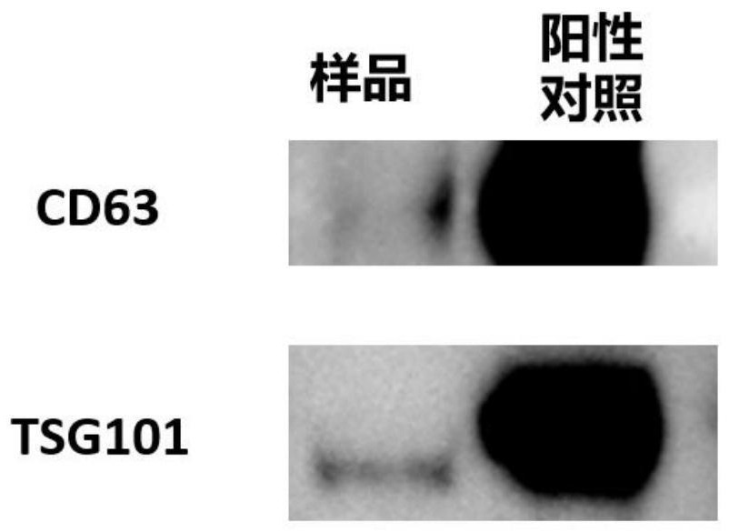 一种羊胎盘外泌体的制备方法及应用