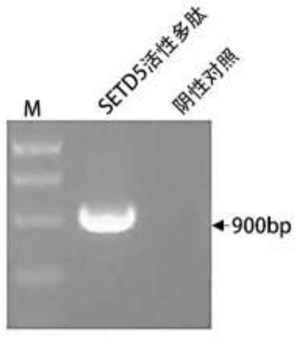 SETD5活性多肽的构建及其促胰岛β细胞再生的活性应用