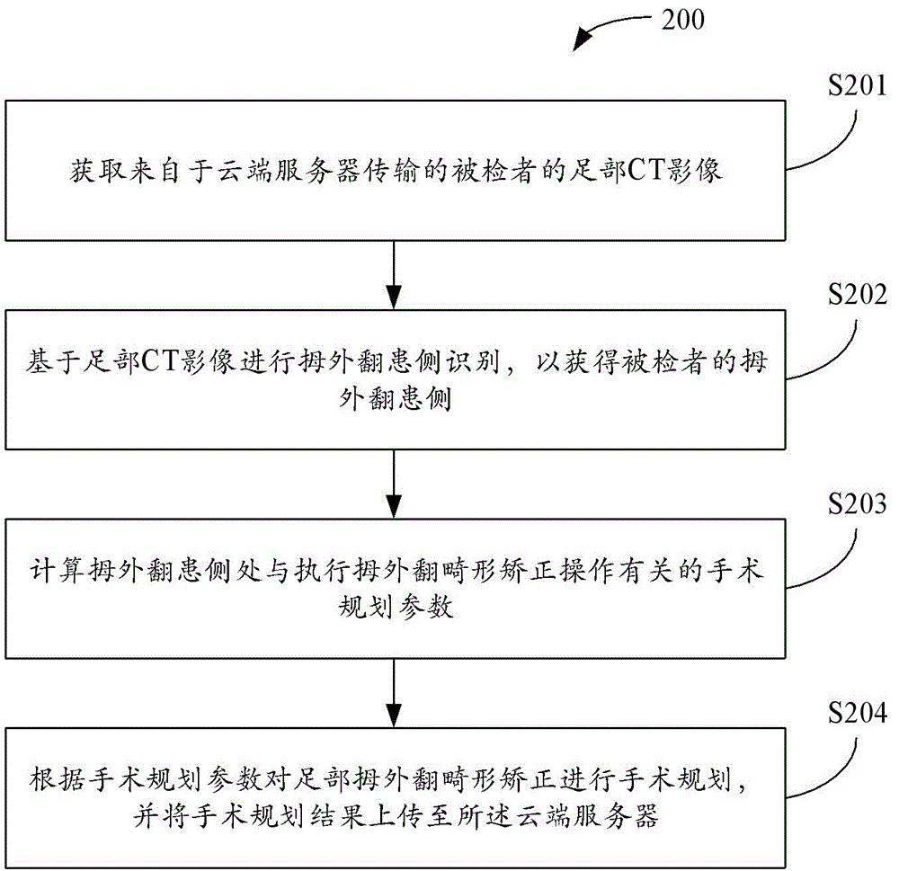 一种用于足部拇外翻手术规划的方法及相关产品