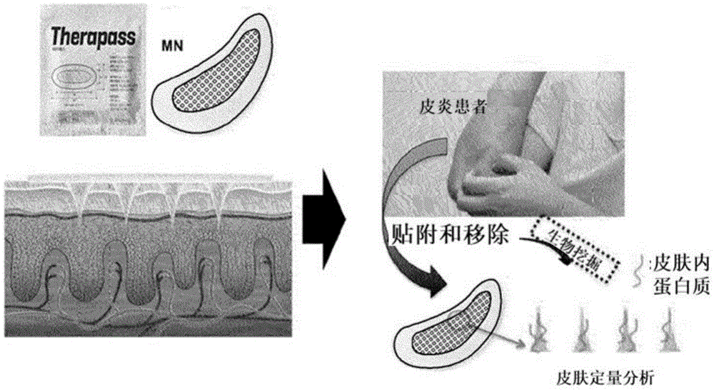 包括微针贴片的微创皮肤状态诊断试剂盒