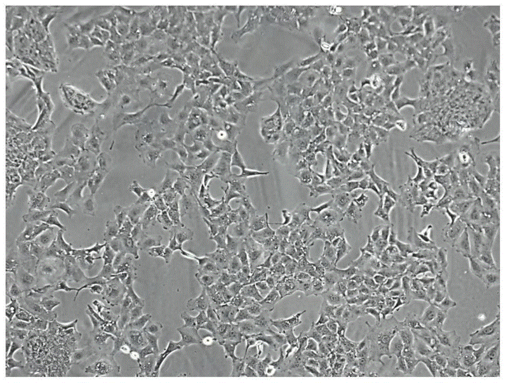 一种小鼠肝内胆管癌细胞系mICCN-4及其建立方法和应用
