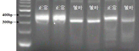 棉花皱叶控制基因GhZY、连锁SNP位点及其应用