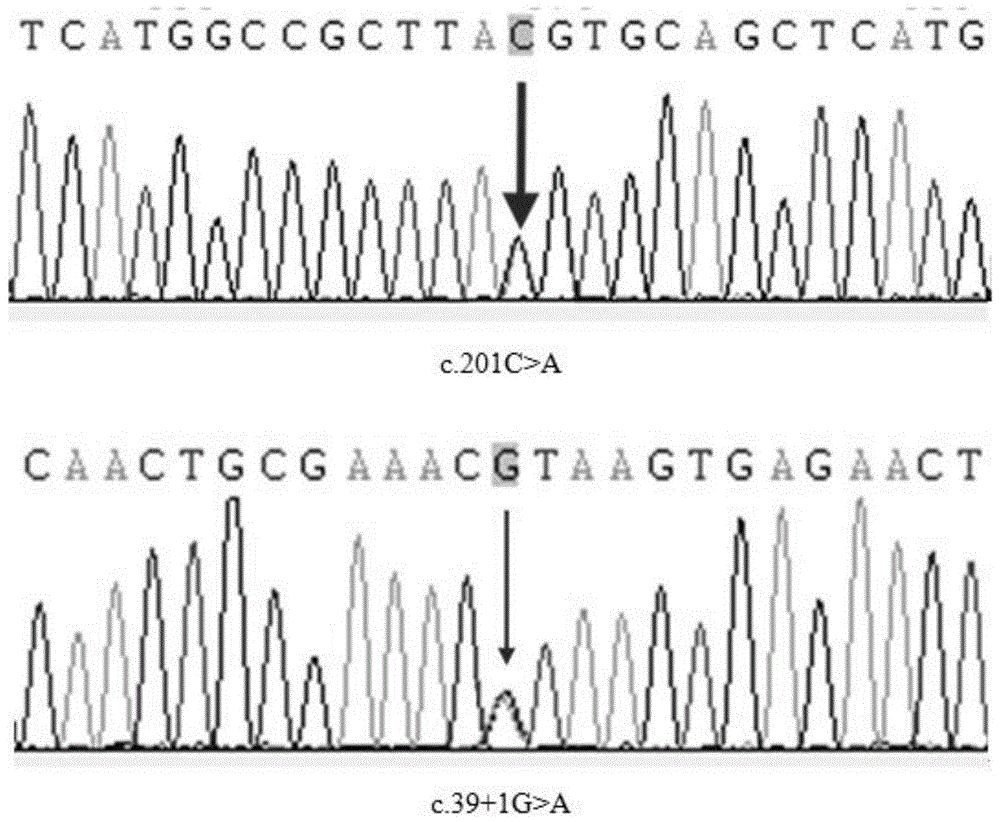 TIMM10B突变基因、检测其的引物、试剂盒和方法以及其用途