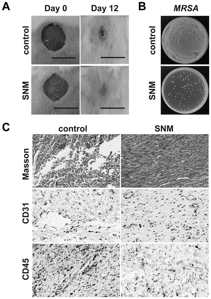 广谱抗微生物的三明治结构的静电纺丝纳米纤维支架及其制备方法