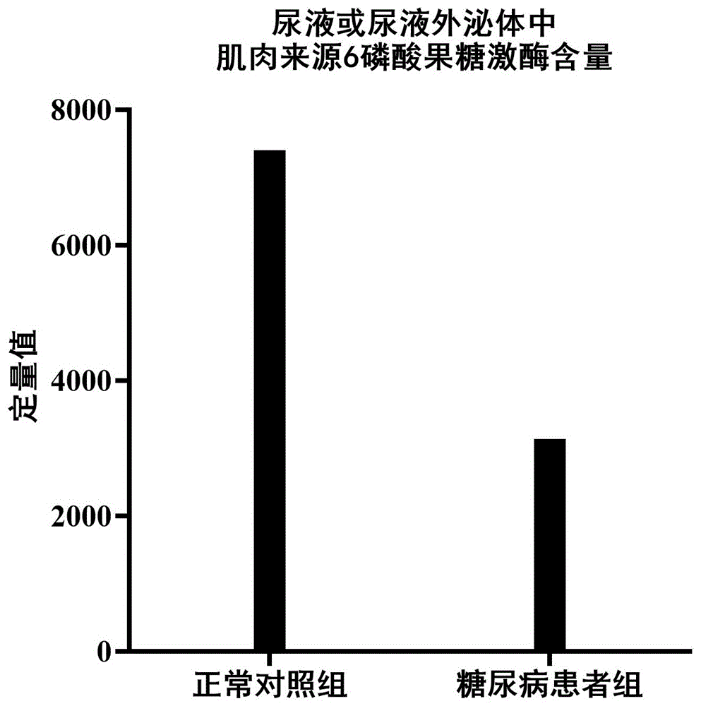 尿液或尿液外泌体中肌肉来源6磷酸果糖激酶及其多肽片段在糖尿病中的应用