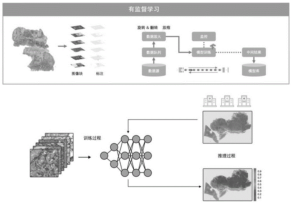 基于级联深度学习的胃部病理诊断与分型系统