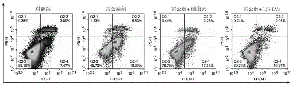 詹氏乳杆菌来源纳米囊泡在制备防治卵巢早衰治疗药物中的应用