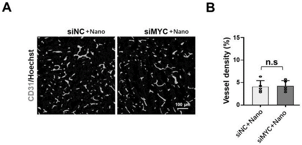 一种靶向MYC的siRNA、基于其的组合物及应用