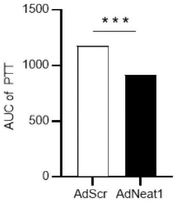 LncRNA NEAT1在糖尿病中的用途