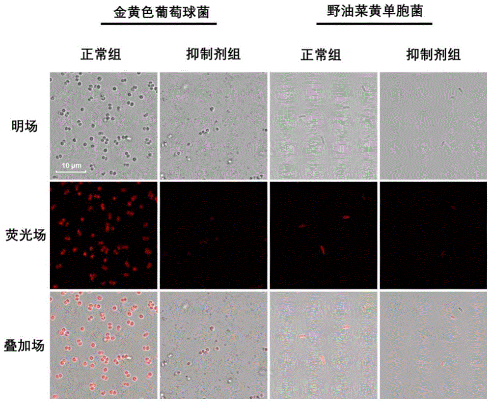 荧光探针化合物作为可特异性识别细菌的荧光探针的应用